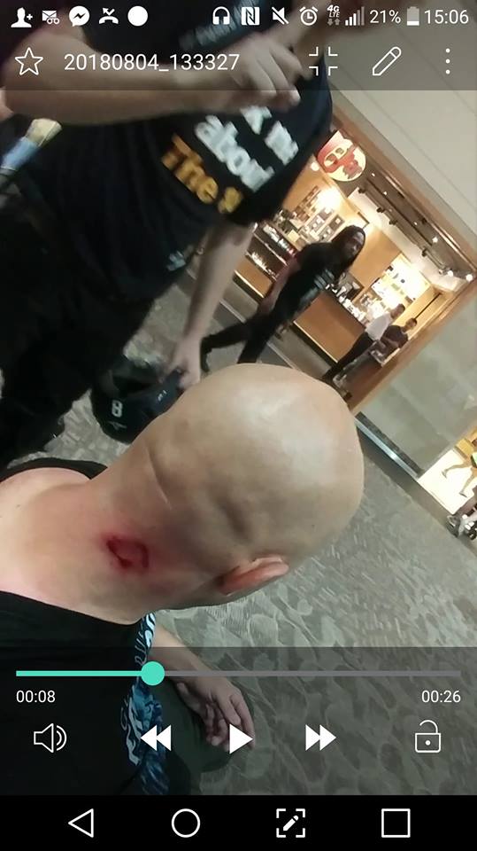 Injury sustained by Samson Racioppi from bike lock by Antifa attack at Providence Rally